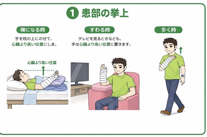 患部の挙上